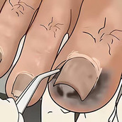 沉浸式采耳修腳版