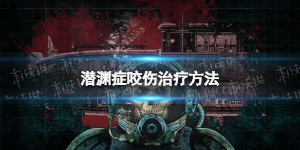 《潛淵症》咬傷治療方法